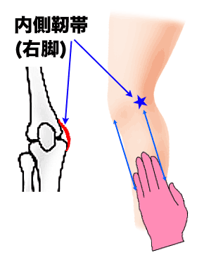 膝内側側副靭帯