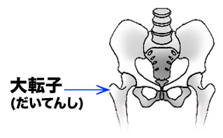 大転子